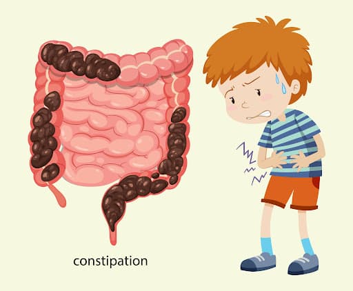 Constipation Overview