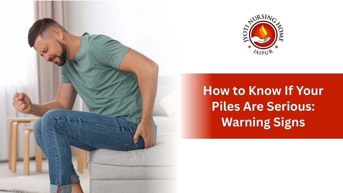 How to Know If Your Piles Are Serious: Warning Signs You Should Never Ignore