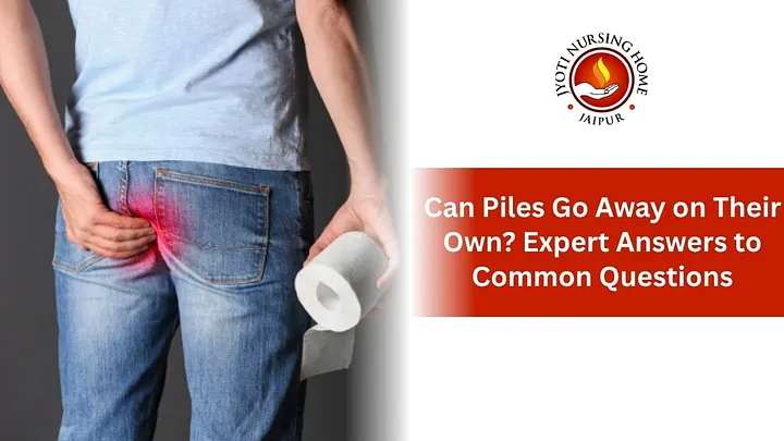 Can Piles Go Away on Their Own? Expert Answers to Common Questions
