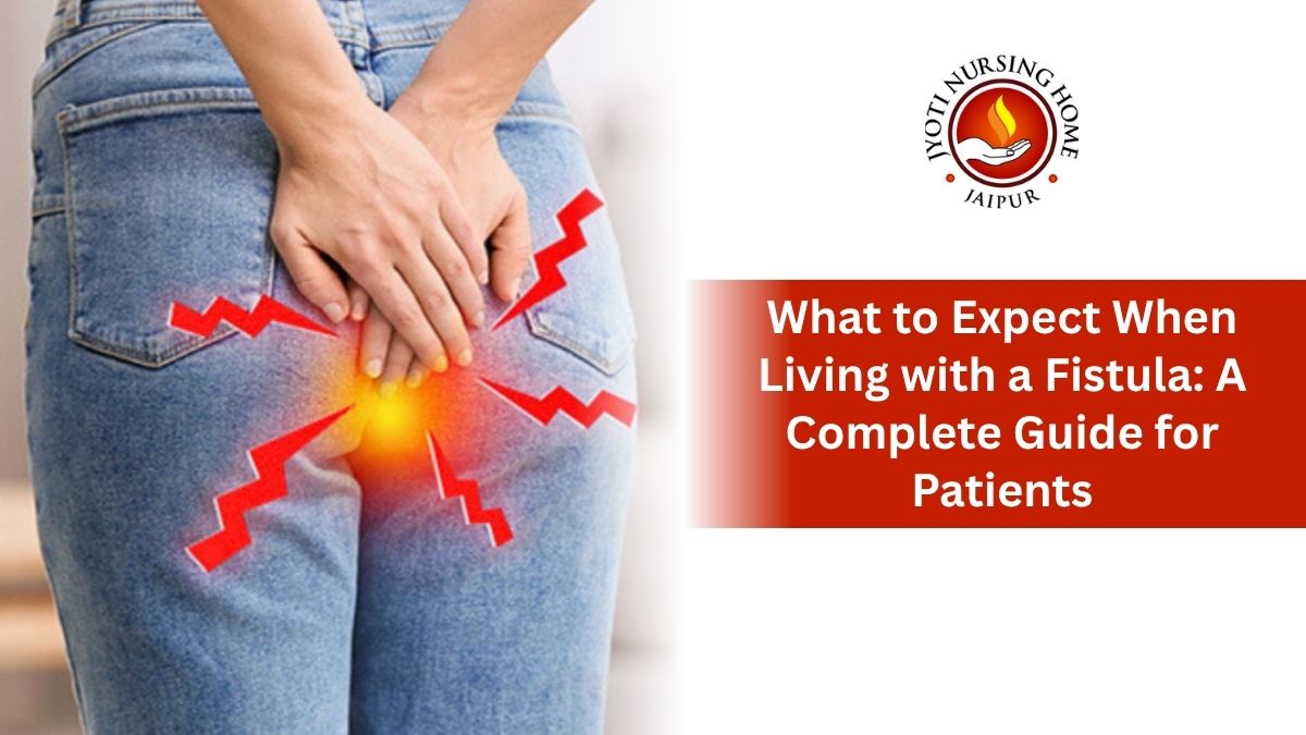 What to Expect When Living with a Fistula: A Complete Guide for Patients